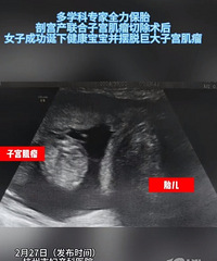 ��8�ܺϲ�13cm�޴��ӹ�������������ƽ��������