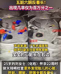 ���赮�¾��汦�������ּ��ʽ�Ϊ�����֮һ