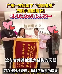 ���赮�¾��汦�������ּ��ʽ�Ϊ�����֮һ