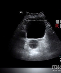 6��Ů�����¾���ȷ����