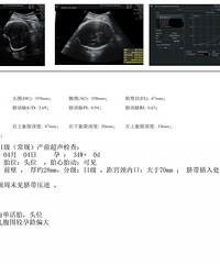 ������һ�ݾ޴�����2025�����ռǡ�