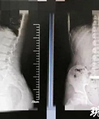 �桤�̽��ޣ�11���к�����100��Ӳͨ��.......