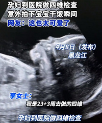 �и�����ά�������±����ɷ�˲��