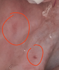 �ڶ���rmҽԺ������������LS