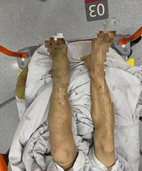 ����߷��ڣ�̨��һ���ӱ�ҧһ�ڣ��׵����ϣ�������Զ��