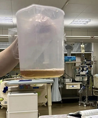 ����һ����ʳ��5���޽���ICU���ⲡ�Ϸ��߷����ܶ�ҳ���֪��