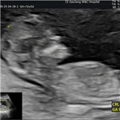 �����ռ�