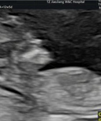 �������ˡ�2025�����ռǡ�