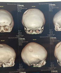 8����ͯ��������������ͷ����������­���������ѱ��̾У�