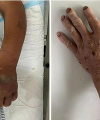 ���衰�߳�û����̨��һ���ӱ�����ҧ�ˣ���Щ��������Ҫ�ܿ�