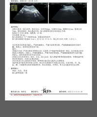 36wB超体重预估只有4.6,38w预估5.9斤,只能忍着馋