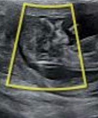 ��ӭ�����ҵı�����2025�����ռǡ�