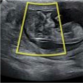 ��ӭ�����ҵı���