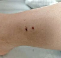 26��Ů�ο���̨��һ�Ƶ��ɱ�����ҧ�ˣ�һ�����ǲ����󡭡�