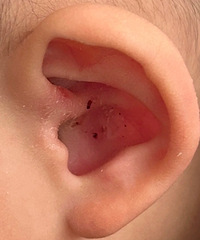 [Ϊʲô]ʮ���䱦����������ץ�ƶ��䣿��ҩ���Ƽ���