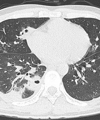 ����һ�Ŷ�����20�������α����С���10����ն���