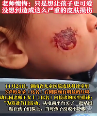 3��Ůͯ��������ֽ��Ƥ�����ã�������ֽ�򺬼�ȩ���к��ɷ�