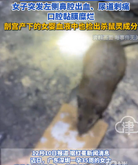 ��35��Ů����ҩ�ж��ʸ�����ŮӤ