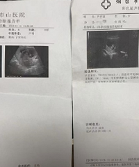 ̫���ף��ѻ�����Ů����������B����ƭ��