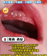 2���±��������̵������ICU