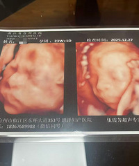 �����޳�������Ⱥ�����������Ҷһ�