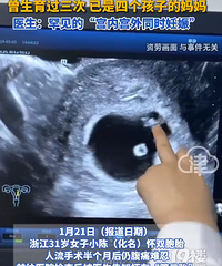 31��Ů����˫̥�������º��ֵ�����