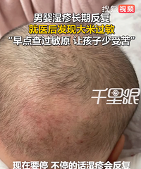 7�´���Ӥ������ʪ�������׹��������裺ƽʱ��ι�׺�