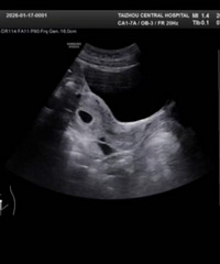 ������������ʱ�⡾2026�����ռǡ�