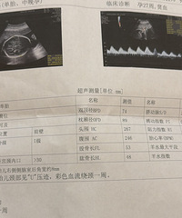 ⧲������Ķ�̥����һ���µ�ʱ�����������裬�����˵���Լ�