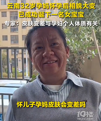 32�����軳�к���ò�仯���ԣ�ר�ұ�ҥ����������Ƥ������