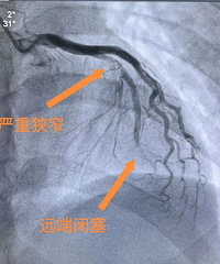 ̨��33��С��˯���������Ĺ������ҽԺ������3�������Ĺ�����