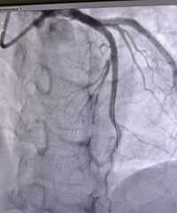 ̨��33��С��˯���������Ĺ������ҽԺ������3�������Ĺ�����