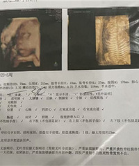 �ֿ��Թ�������һ���˳������˵ķ�����