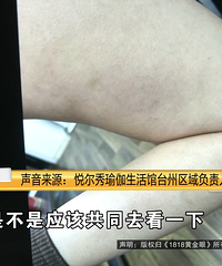 ��̫���ˣ��������ɽ�һ�¡���̨��Ů����������������ȥ�ĺۼ�