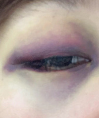 �ڷ����®�۾�ײ���ˣ���Ҫ�⳥��