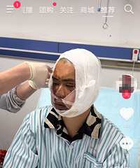 ̨��һ���챻ը�ˣ����ǼҰ�������+����