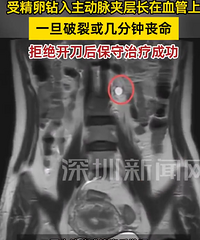 ��������Ů�ӹ�������̥�����������Ѫ����