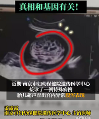 ���췢��̥�������踹�������ӣ������������ȱ��