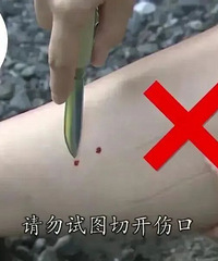 ��������������̨����Щҽ�ƻ����䱸���߶�Ѫ��