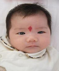"新生儿身上这种胎记,初生很美,后期很严重,妈妈一定要当心"