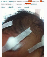 【爆料】义乌稠江街道的医生敢再专业点吗 小朋友不是小白鼠啊