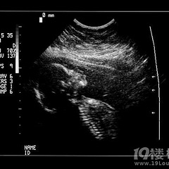 七个月胎儿四维彩超
