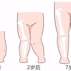 这些习惯影响宝宝腿发育,尤其是穿这两种鞋