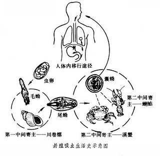 吃没有煮熟的海鲜和肉类,22岁的大二女生小安(化名)患上了肺吸虫病,每