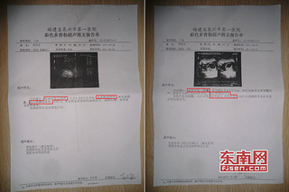 谁能给我发一张,怀孕两个月的胎儿彩超图片.谢谢了.