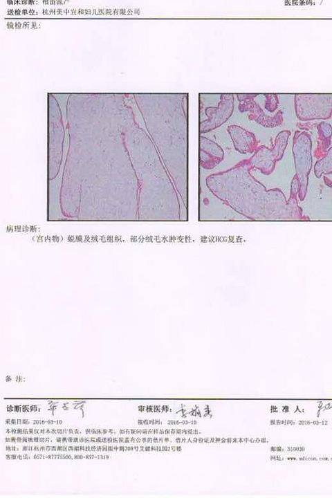 请问从这张报告上能看得出来是完全性葡萄胎