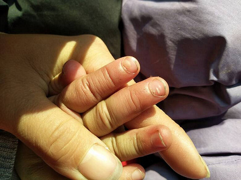 宝宝手指甲黄根部脱皮白点_19楼手机版