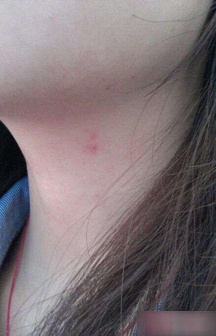 老娘想说今天呢,你们敢和我们已婚秀吻痕么,还有抓痕,咬痕,哈哈哈哈