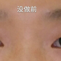 ˫Ƥ;úƯˡ