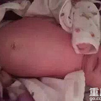 ��ɩ��Ѫ�ܽ���Щ�����������ʹ�һ��������